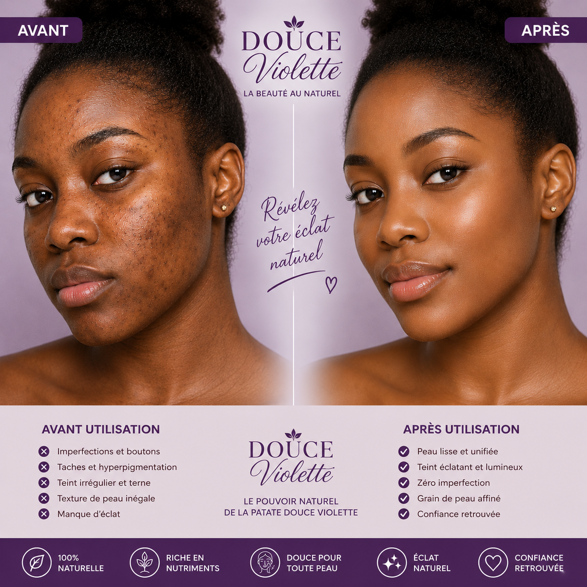Ube Pureté